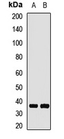 Anti-GNB1 Antibody