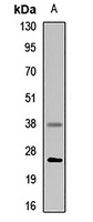 Anti-Cathepsin S Antibody
