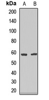 Anti-Endothelial Lipase Antibody