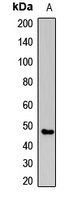 Anti-CLN3 Antibody