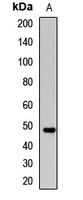 Anti-TMPase Antibody