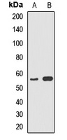 Anti-Cytochrome P450 5A1 Antibody