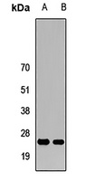 Anti-PRL3 Antibody