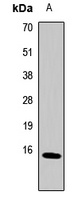 Anti-Metallothionein-2A Antibody