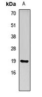 Anti-REG3 gamma Antibody
