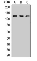 Anti-TIF1 beta Antibody