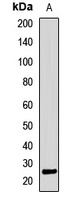 Anti-ALKBH7 Antibody