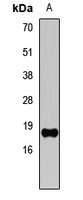 Anti-Histone H3 (TriMethyl-K4) Antibody