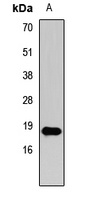 Anti-Histone H3 (TriMethyl-K27) Antibody
