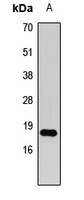 Anti-Histone H3 (DiMethyl-K79) Antibody