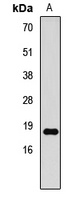 Anti-Histone H3 (DiMethyl-K79) Antibody