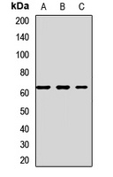 Anti-Squalene Epoxidase Antibody