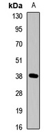 Anti-DKK3 Antibody