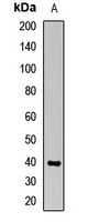 OAS1 antibody