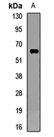 Anti-CD16 Antibody