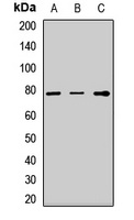 Anti-TGFBI Antibody