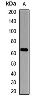 Anti-IGF2BP2 Antibody