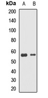 Anti-DNAJC7 Antibody