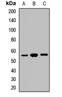 GPT antibody