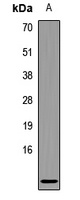 Anti-CCL3L1 Antibody