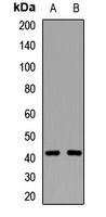 Anti-CD192 Antibody