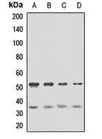 Anti-GFRA2 Antibody