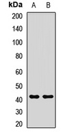 Anti-RAP Antibody
