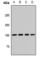 Anti-Neurofascin Antibody
