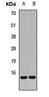 Anti-RAMP2 Antibody