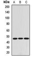 Anti-RBM17 Antibody