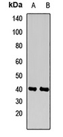 Anti-INPP5A Antibody