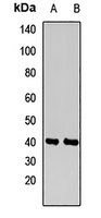 INPP5A antibody