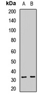Anti-RGN Antibody