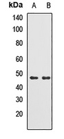 TRMT2B antibody