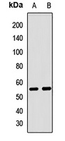 Anti-GABPB2 Antibody