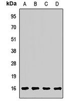 Anti-ARF5 Antibody