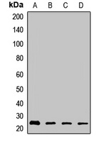 ARHGDIB antibody