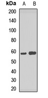 ATP6V1B2 antibody