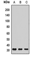 ATP6V1E1 antibody