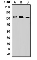 Anti-CD97 Antibody