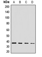 Anti-CPOX Antibody