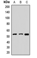 Anti-FDXR Antibody