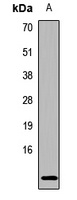 Anti-Hemoglobin epsilon Antibody