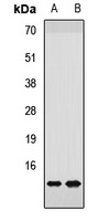 Anti-NDUFS6 Antibody