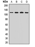 OSBP antibody