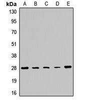 Anti-PMM2 Antibody