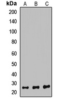 PSMB6 antibody