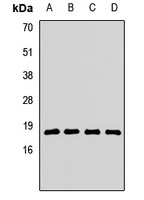 Anti-RPL23A Antibody