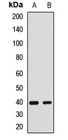 Anti-SH3GL3 Antibody