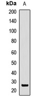 Anti-SFRS9 Antibody